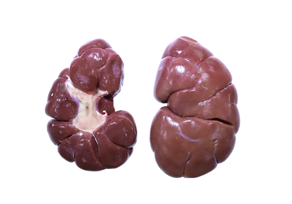 kidney